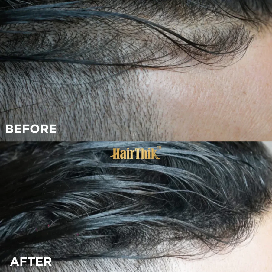 Supreme ST Hair Fibers 11-in-1 Master Finishing Kit - Image 7